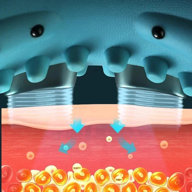 Illustration of a shark's mouth opening to show its teeth and a close-up of skin with oil glands.